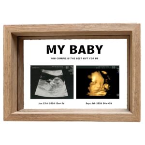 Custom Ultrasound Pregnancy Memorial Frame