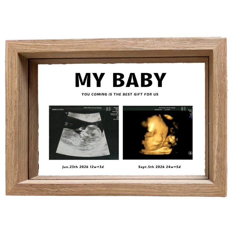 Custom Ultrasound Pregnancy Memorial Frame